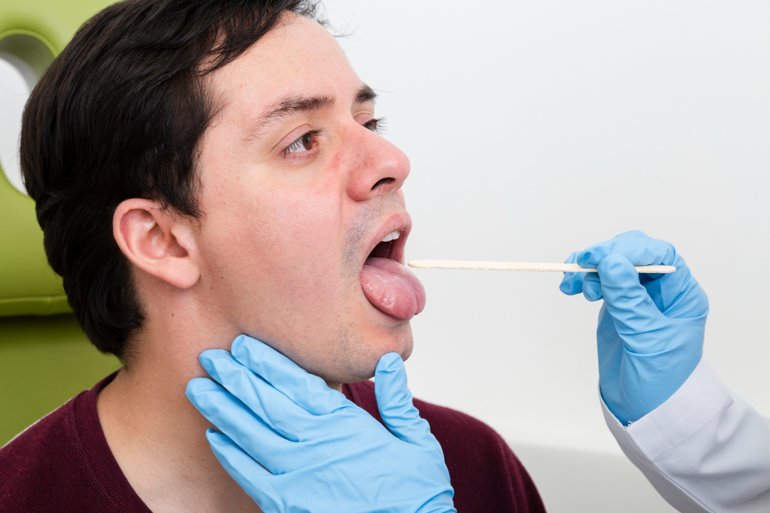 Sublingual Immunotherap