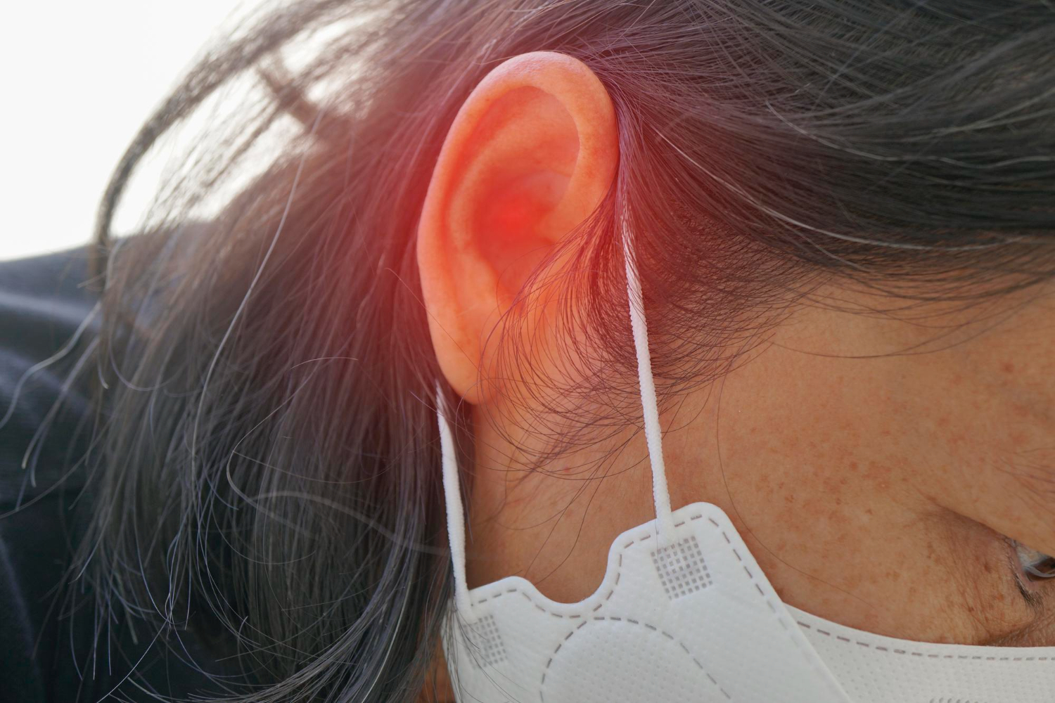 Otoacoustic Emissions